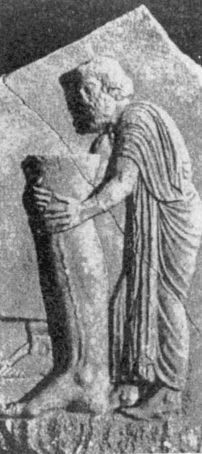 【下肢静脈瘤の歴史】